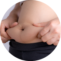 Causes of Liposuction - Fatty areas