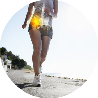 Causes of Hip Replacement Hip Flexor Strain Treatment in Trivandrum